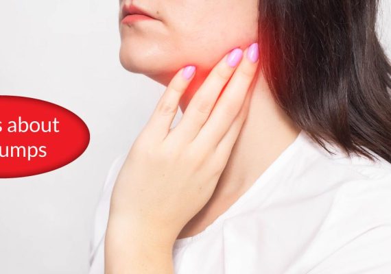 Myths about the Mumps